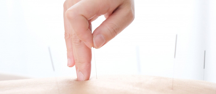 妊娠する力をとりもどす鍼灸施術